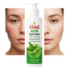 J.Laal ACNI Face Wash – Daily Cleansing for Acne Control | For All Skin Types | 120ml